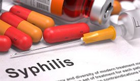 Сифилис – симптомы, причины, фото и лечение сифилиса